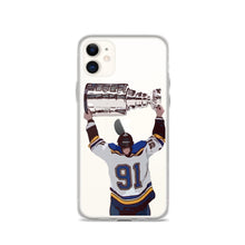 Vlad the Champ iPhone Case